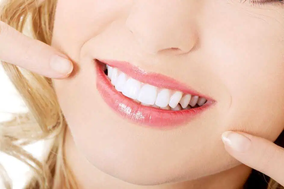 Minimal-Prep Veneers in Oklahoma City by Dr. Matthew Guffe