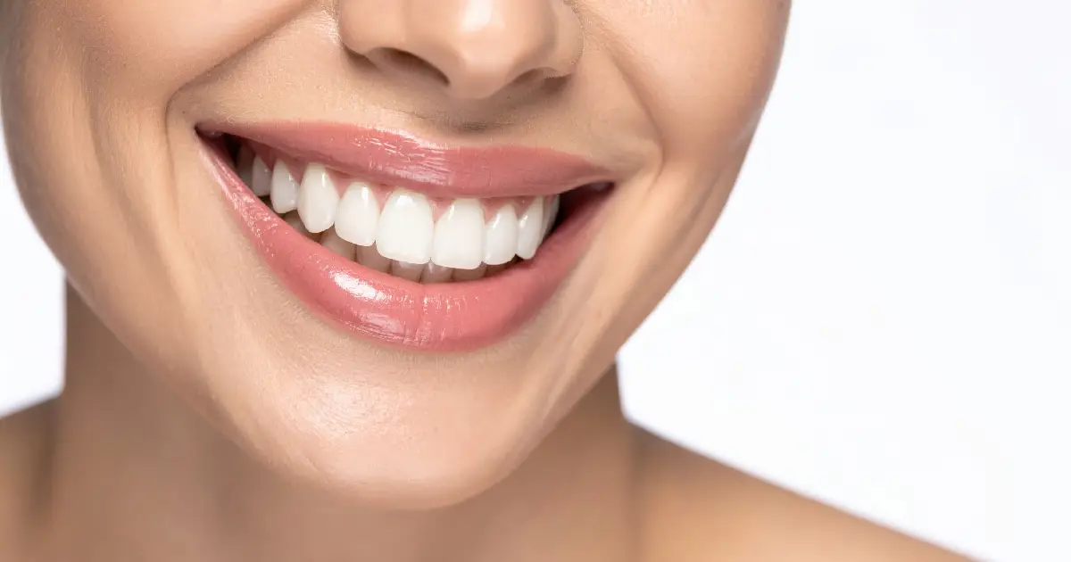 How Minimal-Prep Veneers Preserve Your Natural Smile